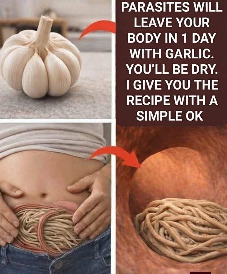 Garlic removes parasites in just 1 day